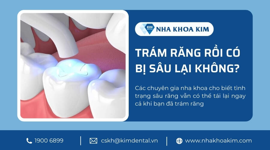 Trám răng rồi có bị sâu lại không?