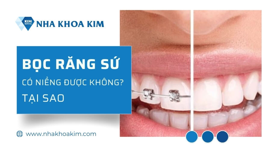 Răng bọc sứ có niềng được không?
