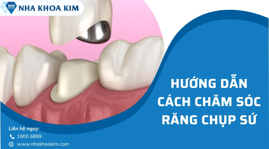 Cách chăm sóc răng chụp sứ