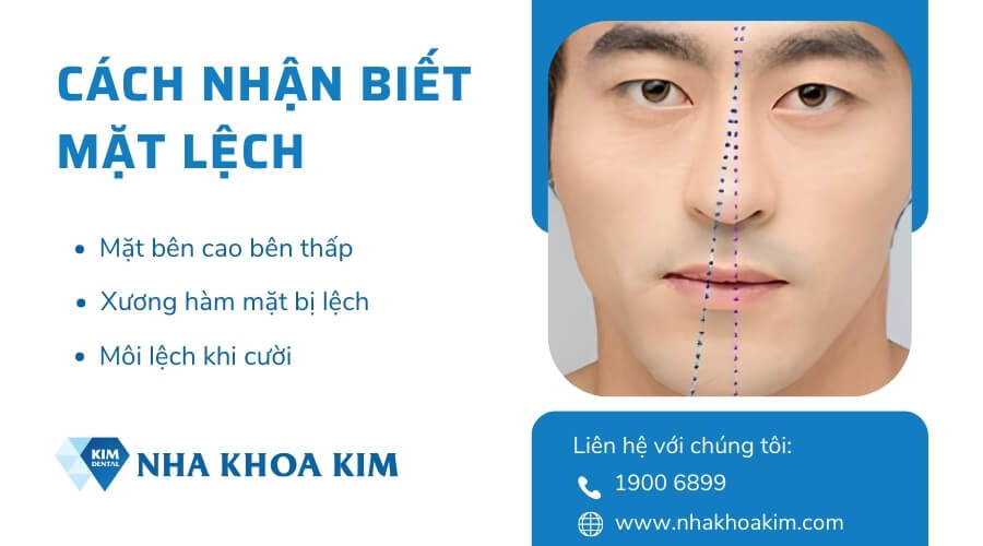 Cách nhận biết mặt lệch