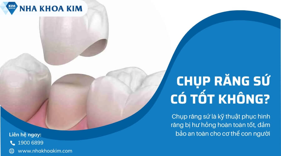 Chụp răng sứ có tốt không?