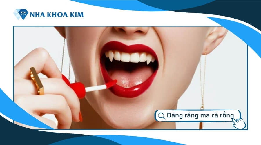 Dáng răng ma cà rồng