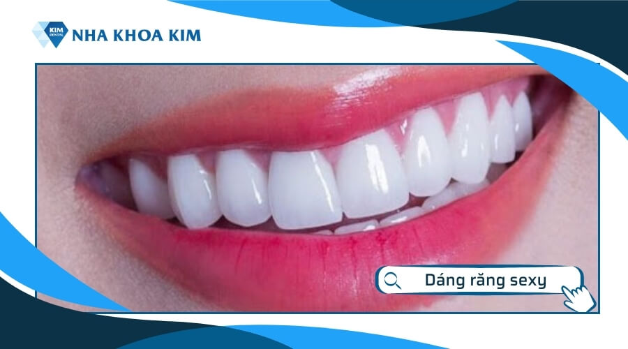 Dáng răng phong cách sexy