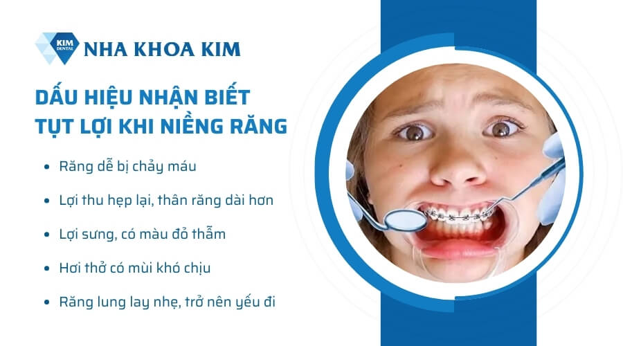 Các dấu hiệu nhận biết tụt lợi khi niềng răng