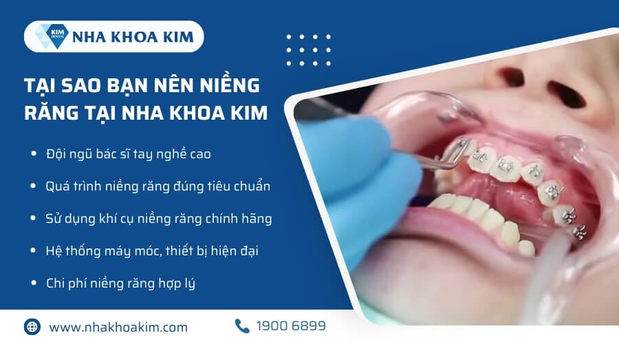 Nha Khoa Kim – Địa chỉ niềng răng đẹp, hiệu quả và an toàn