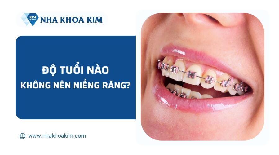 Độ tuổi nào không nên niềng răng?