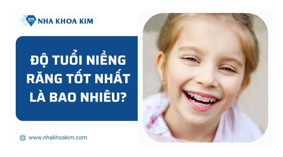 Niềng răng ở tuổi nào? Độ tuổi nên và không nên niềng răng?
