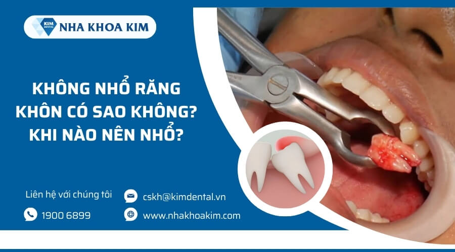 Không nhổ răng khôn có sao không?