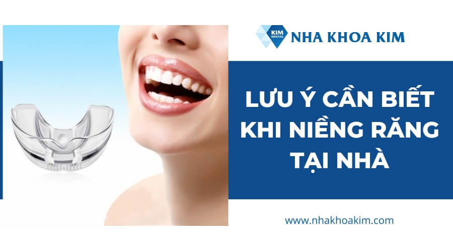 Những lưu ý cần biết khi niềng răng tại nhà