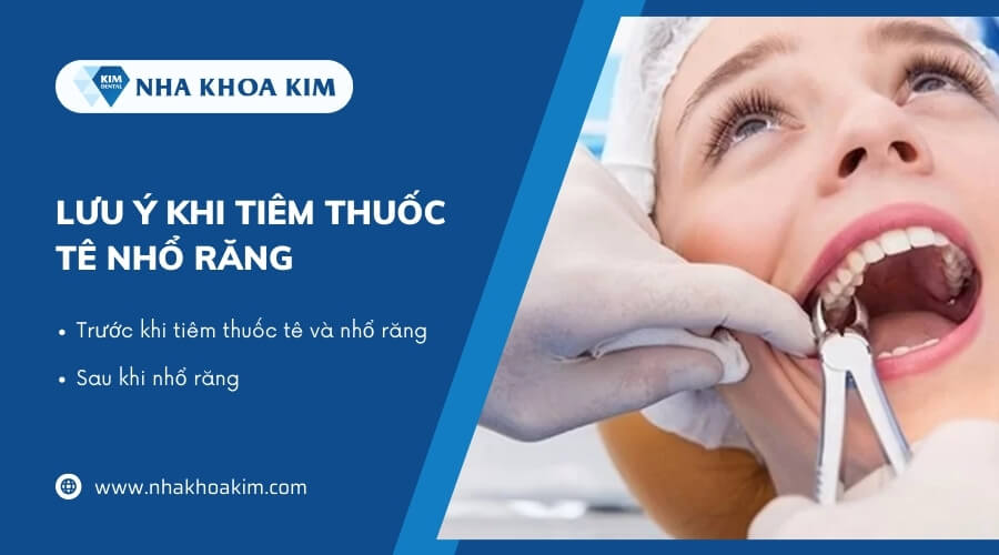 Lưu ý khi tiêm thuốc tê nhổ răng