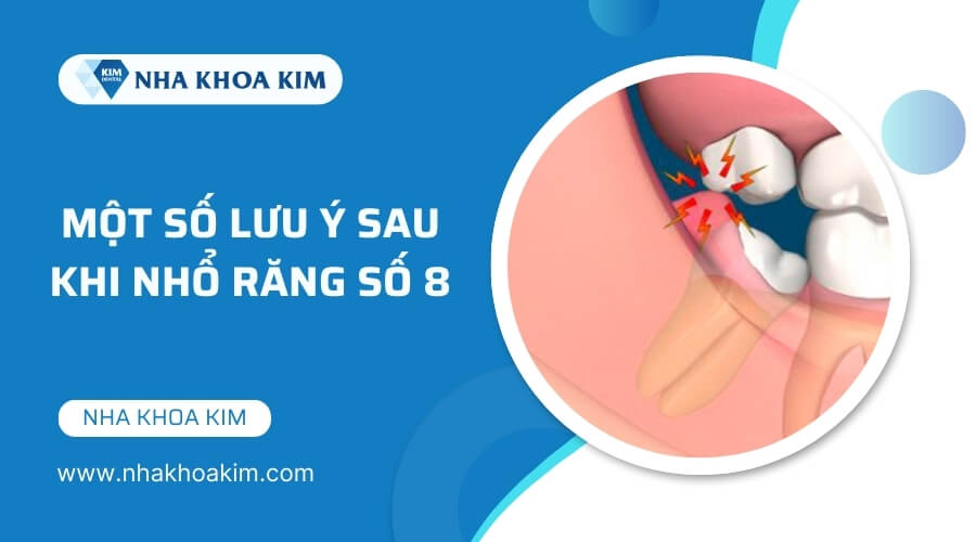 Lưu ý bạn cần biết sau khi nhổ răng số 8