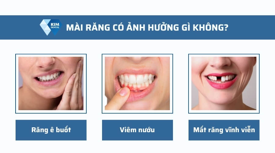 Mài răng có ảnh hưởng gì không?