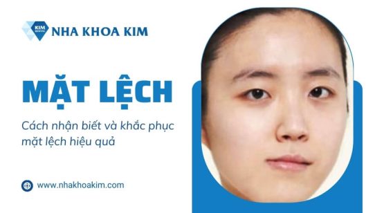 Mặt lệch: Cách nhận biết và khắc phục mặt lệch hiệu quả