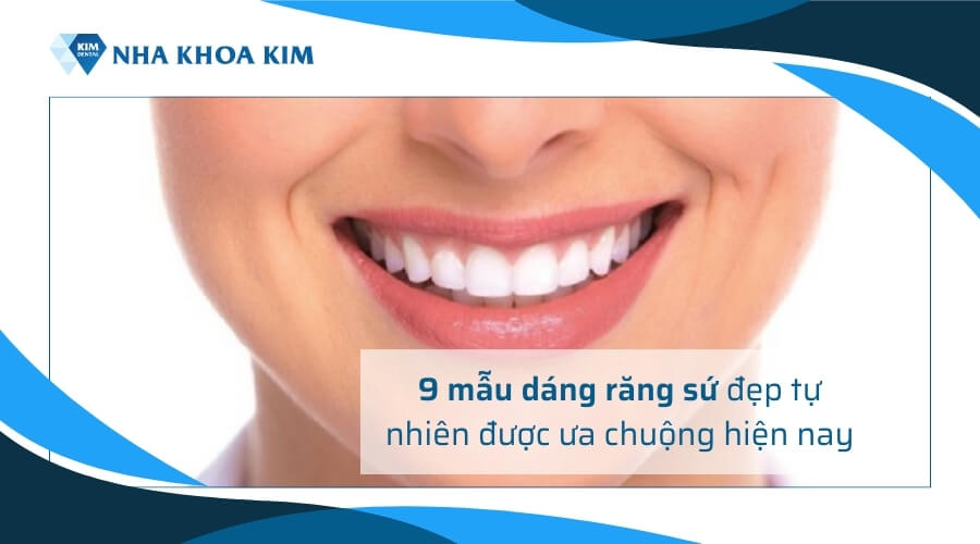 9 Mẫu dáng răng sứ đẹp tự nhiên được ưa chuộng hiện nay