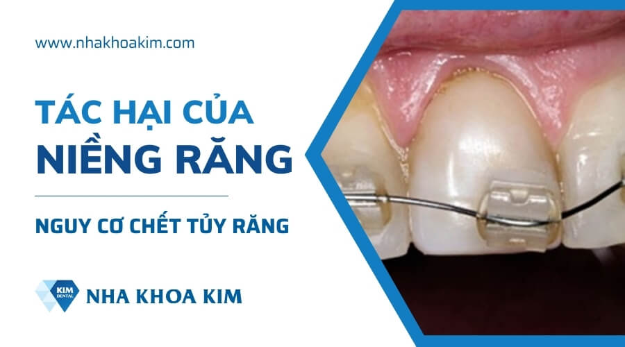 Tác hại của niềng răng sai cách