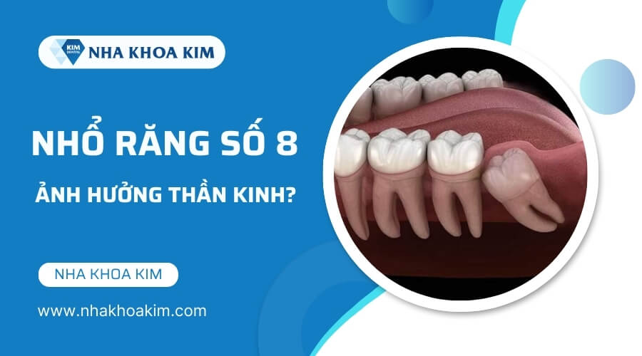 Nhổ răng số 8 có ảnh hưởng thần kinh không?