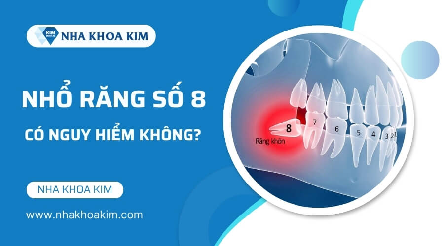 Nhổ răng số 8 có nguy hiểm không?