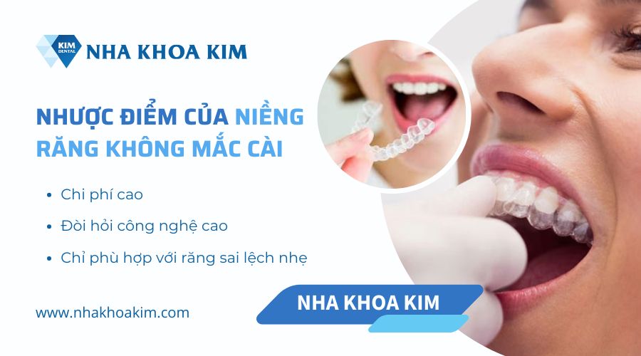 hạn chế khi niềng răng hiện đại không mắc cài