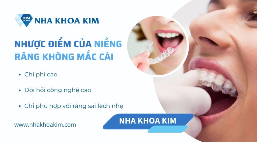 Nhược điểm của niềng răng không mắc cài