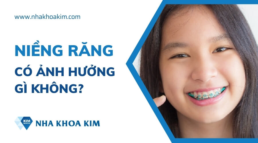 Niềng răng có ảnh hưởng gì không?