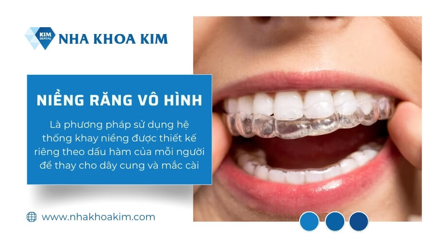 Niềng răng sứ bằng phương pháp niềng răng vô hình