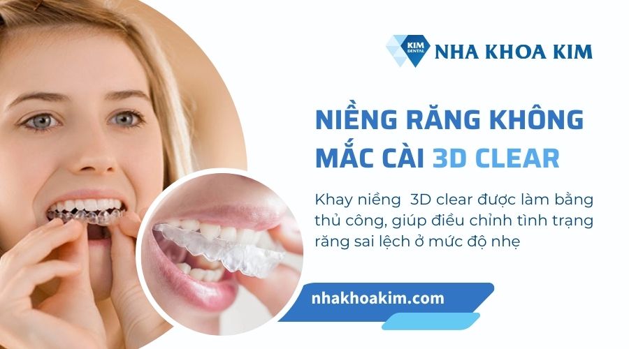 niềng răng 3d clear