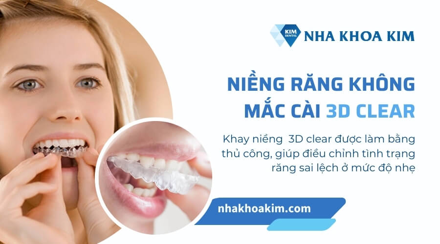 Niềng răng 3D clear