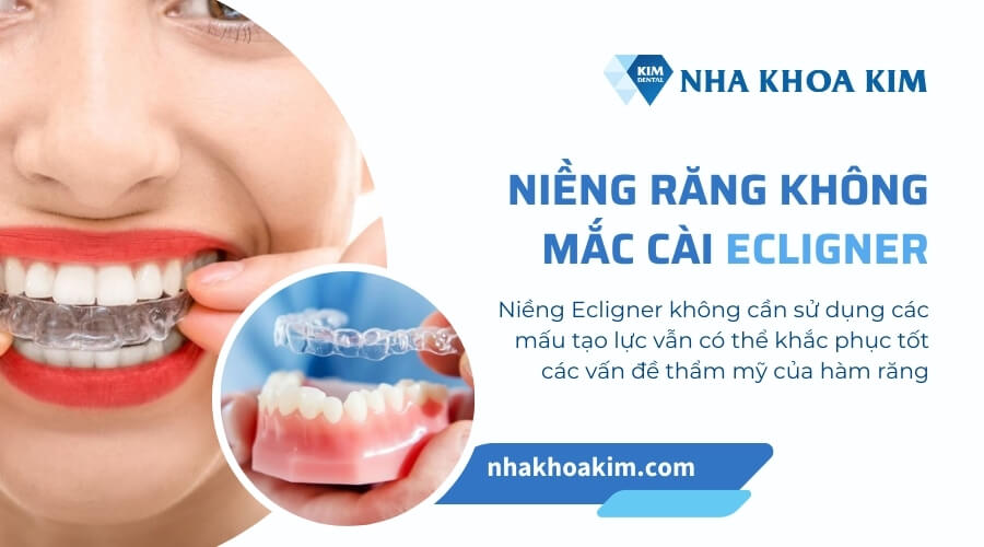 Niềng răng Ecligner
