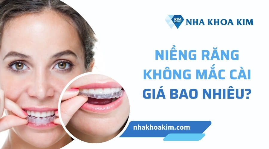 Chi phí niềng răng không mắc cài giá bao nhiêu?