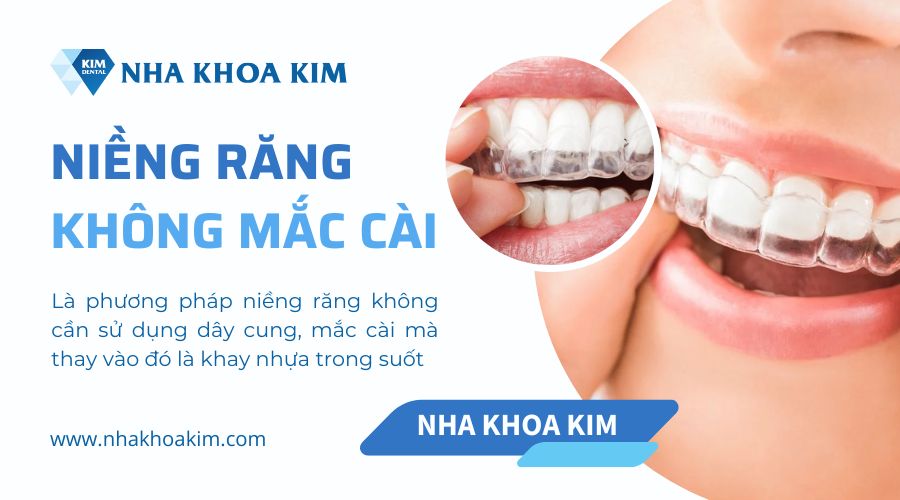 niềng răng không mắc cài là gì