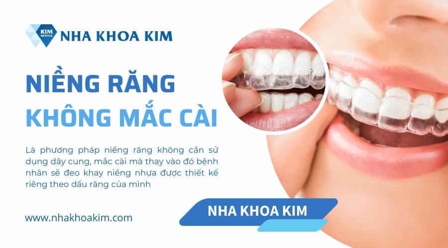 Niềng răng không mắc cài là gì?