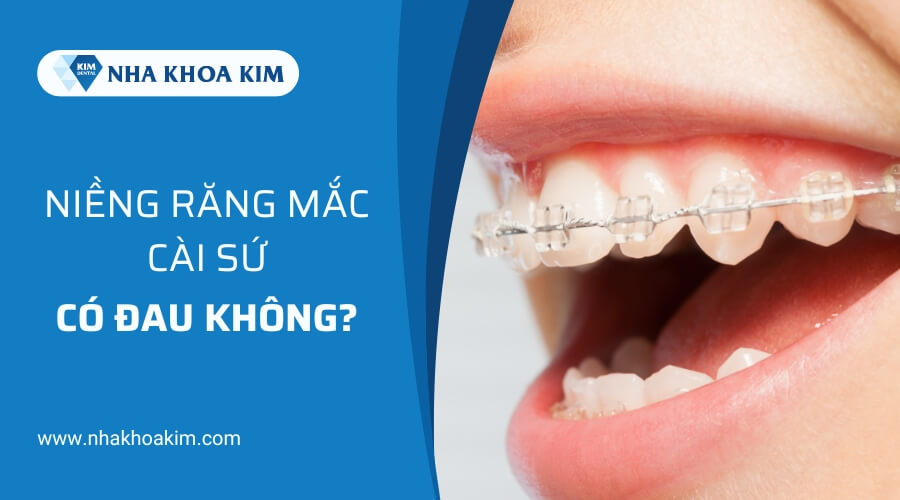 Niềng răng mắc cài sứ có đau không