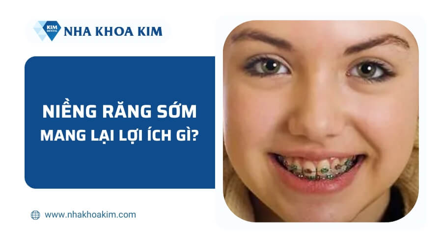 Niềng răng sớm mang lại lợi ích gì?