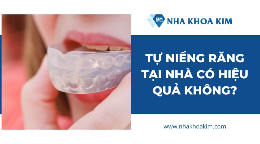 Tự niềng răng tại nhà có hiệu quả không?