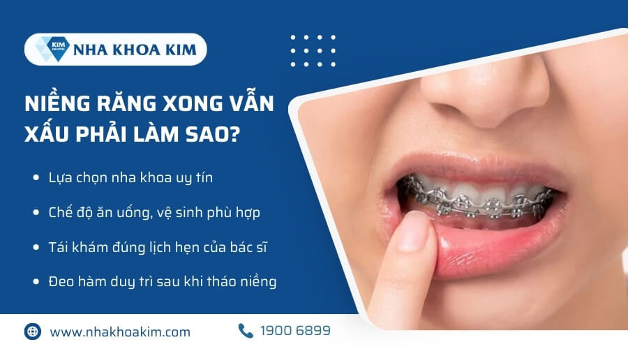 Niềng răng xong vẫn xấu phải làm sao?
