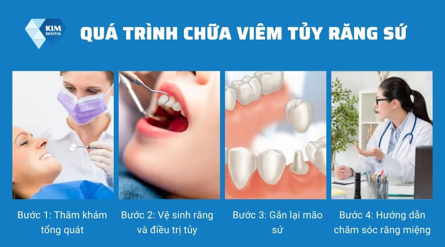 Cách chữa tủy răng đã bọc sứ