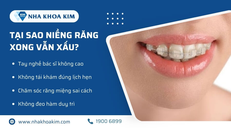 Tại sao niềng răng xong vẫn xấu?