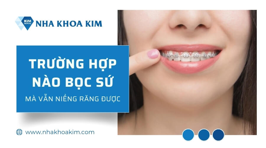 Trường hợp nào bọc sứ mà vẫn niềng được