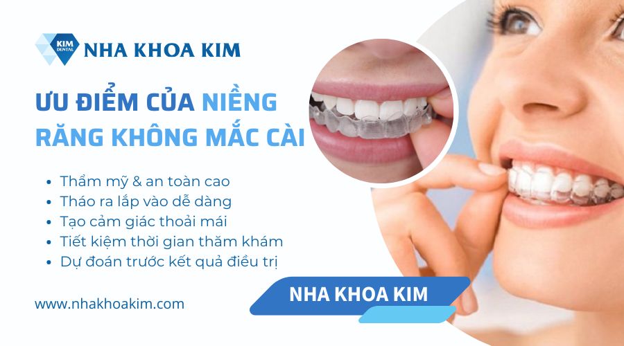 ưu điểm khi niềng không mắc cài