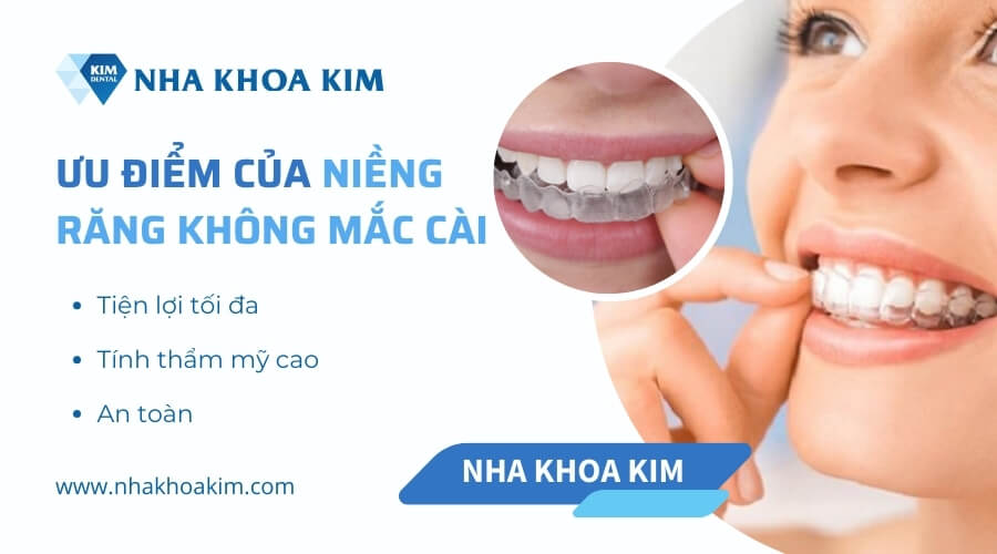 Ưu điểm của niềng răng không mắc cài