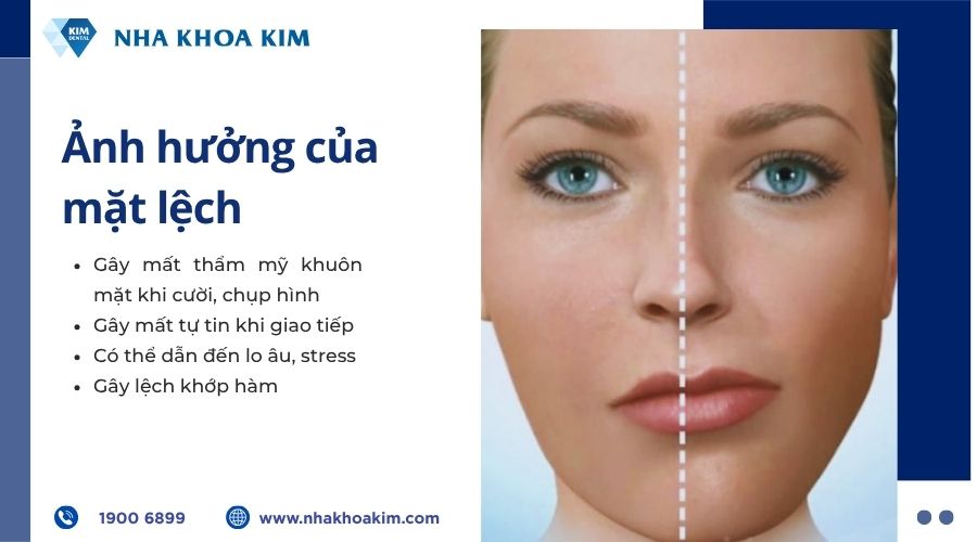 ảnh hưởng của mặt lệch đến khuôn mặt