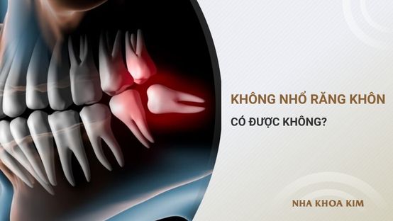 Không nhổ răng khôn có sao không? Khi nào nên nhổ?