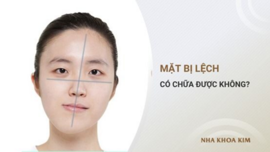 Mặt lệch: Cách nhận biết và khắc phục mặt lệch hiệu quả