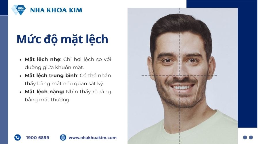 mức độ của lệch mặt