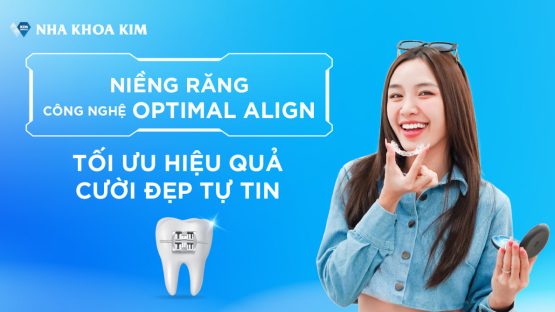 Niềng răng công nghệ Optimal Align: Tối ưu hiệu quả – Cười đẹp tự tin