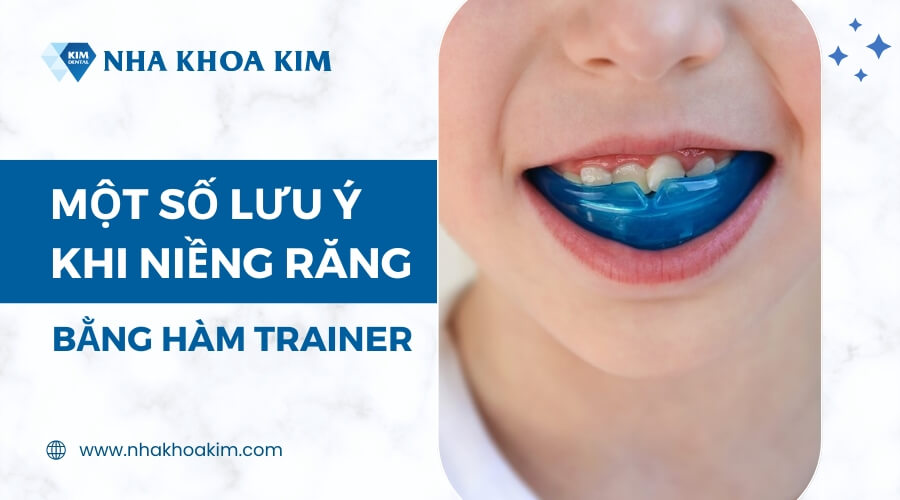 Những lưu ý khi niềng răng bằng hàm trainer