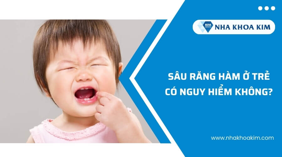 Sâu răng hàm ở trẻ có nguy hiểm không?