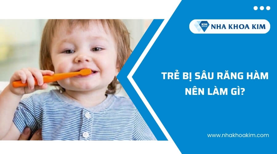 Trẻ bị sâu răng hàm nên làm gì?