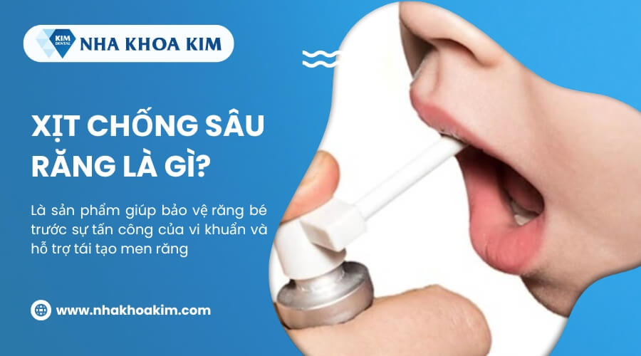 Xịt chống sâu răng là gì?