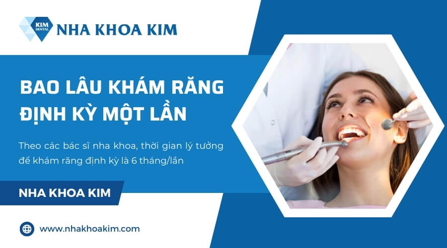 Bao lâu nên khám răng định kỳ một lần?